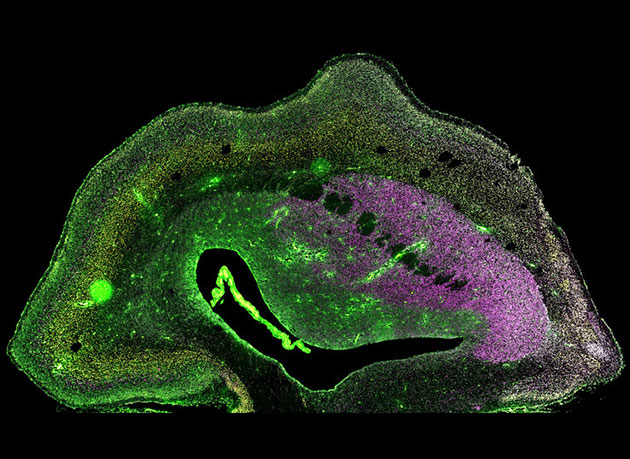 Mikroskopische Aufnahme eines Hirnhälften-Schnitts eines 101 Tage alten ARHGAP11B-transgenen Weißbüschelaffen-Fötus. Verschiedene neuronale Populationen sind durch Immunhistochemie (magenta, gelb, grün) sichtbar gemacht. Die Zellkerne sind weiß dargestellt. Copyright: Heide et al. / MPI-CBG